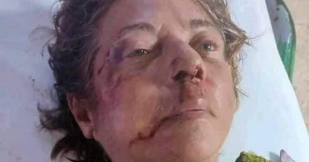 Recordada periodista Nora Susana López Díaz, quien falleció en Ciego de Ávila tras ser víctima de un atropello con fuga.