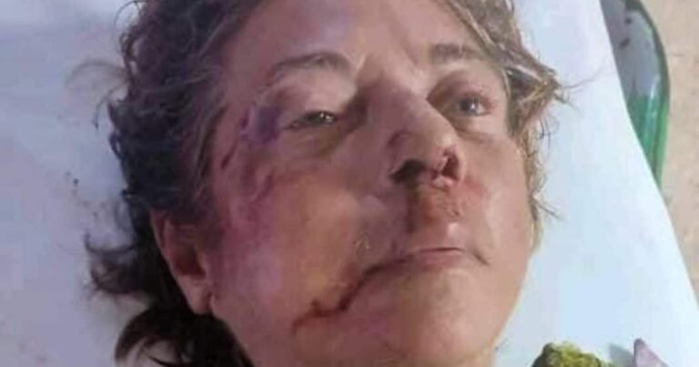 Recordada periodista Nora Susana López Díaz, quien falleció en Ciego de Ávila tras ser víctima de un atropello con fuga.