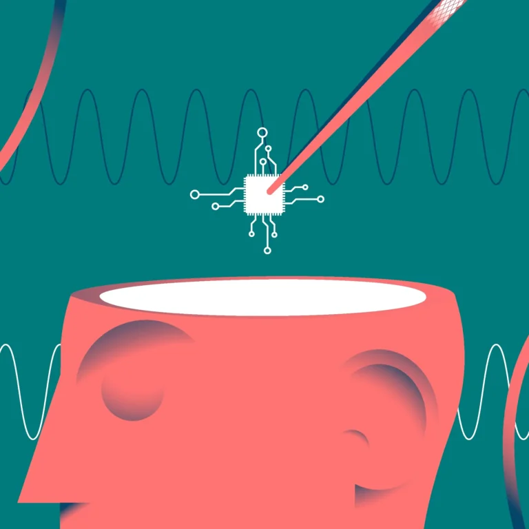 Ilustración del implante cerebral Blindsight de Neuralink, diseñado para devolver la vista a personas ciegas.