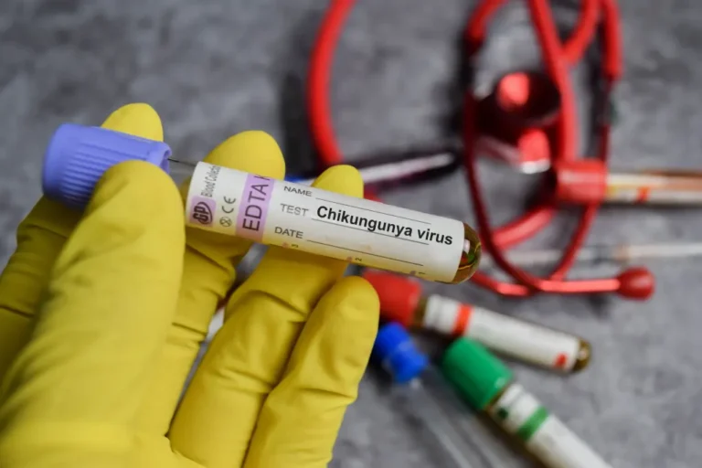 Confirman el primer caso local de virus chikungunya en seis años