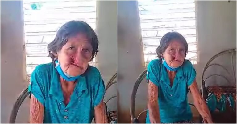 Mujer con Cáncer en Gibara Sobrevive sin Tratamiento ni Alimentos