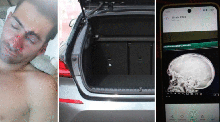 Madre denuncia brutal asalto a su hijo en carretera central: «La policía estaba a 200 metros, lo vieron todo y no hicieron nada»